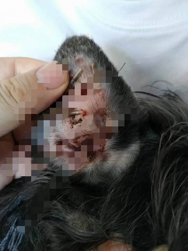 耳血腫病例恢復