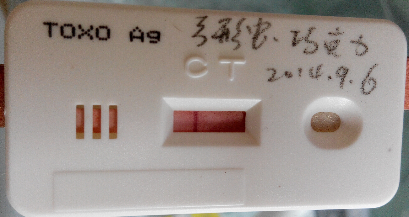 弓形蟲檢測(cè)