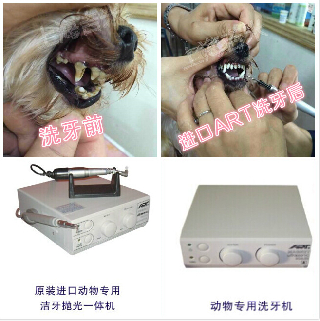洗牙，潔牙